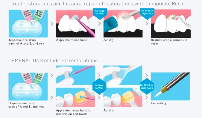 Tokuyama Palfique Universal Bond Kit